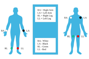 12 lead ecg placement color coded
